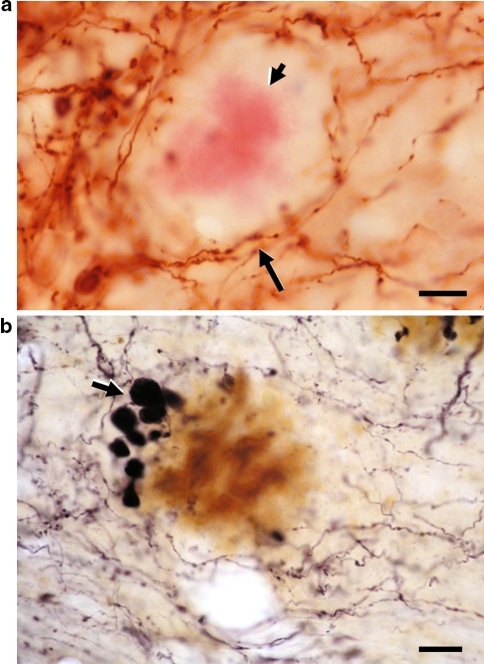 Fig. 1a–b