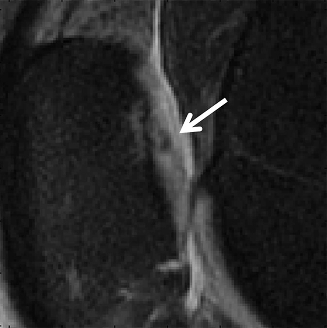 Figure 4a: