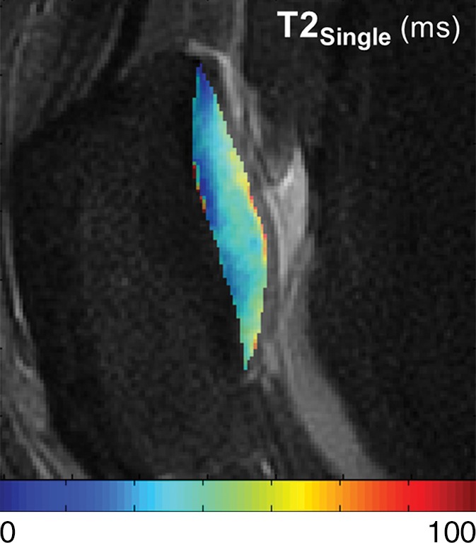 Figure 3b: