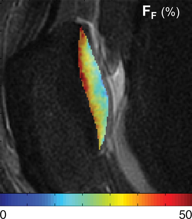 Figure 3e: