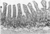 122