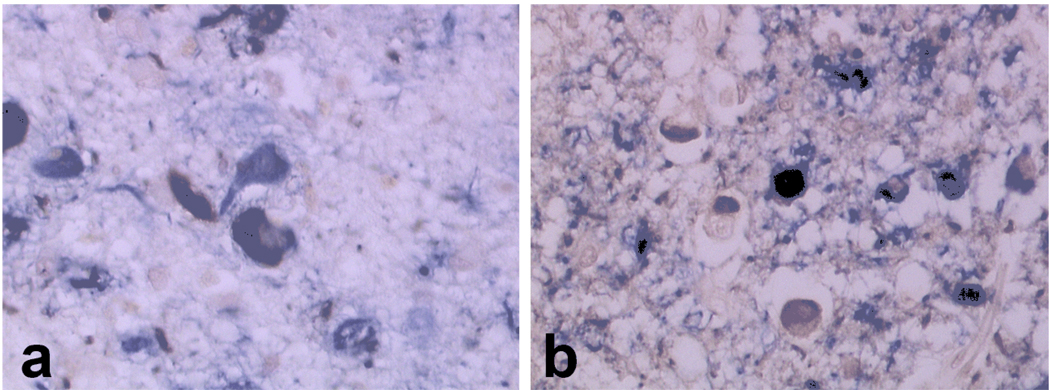 Fig.1