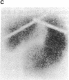 1915