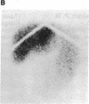 1915