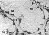 79