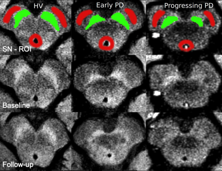FIG. 1