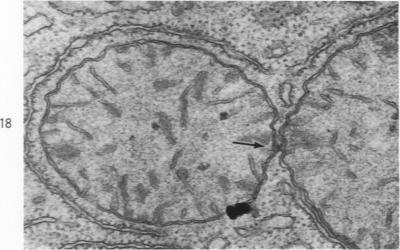 Fig. 18