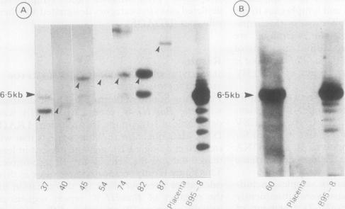 graphic file with name jclinpath00412-0054-b.jpg