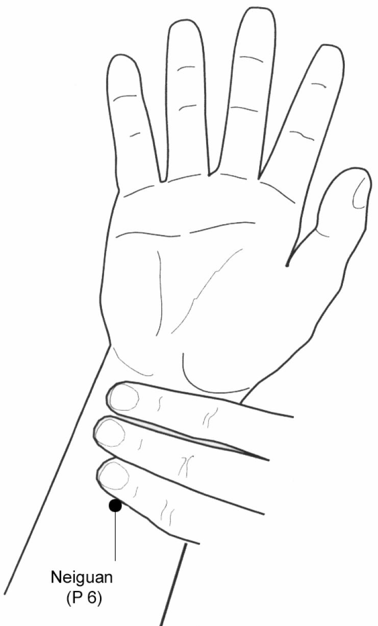 Fig. 9