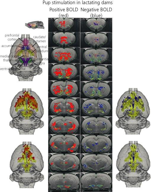 FIG. 11