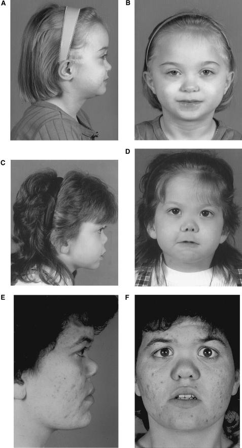 Figure  2