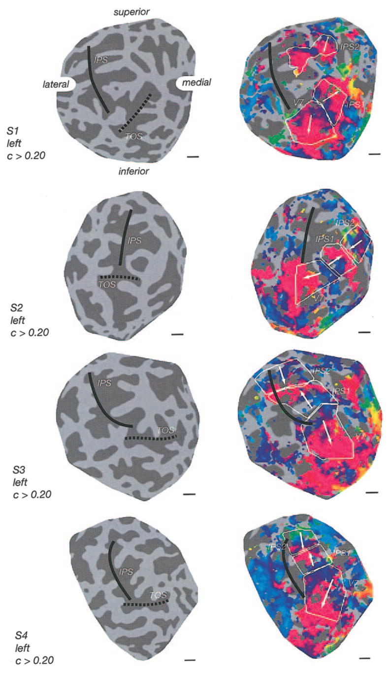 FIG. 4