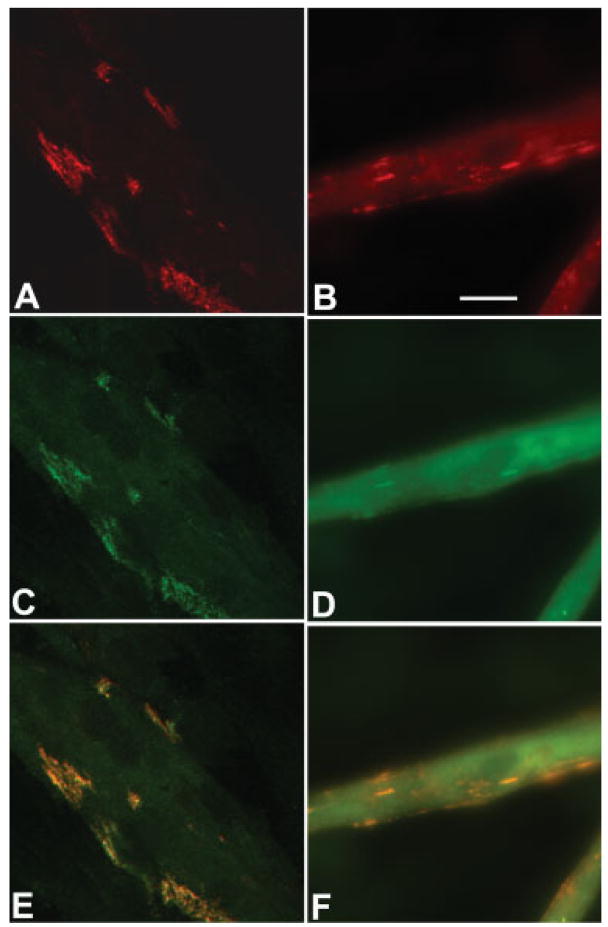 Fig 11