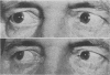 117