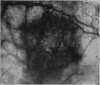 256-2