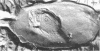 376
