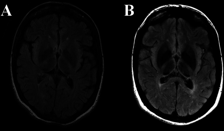 Figure 2