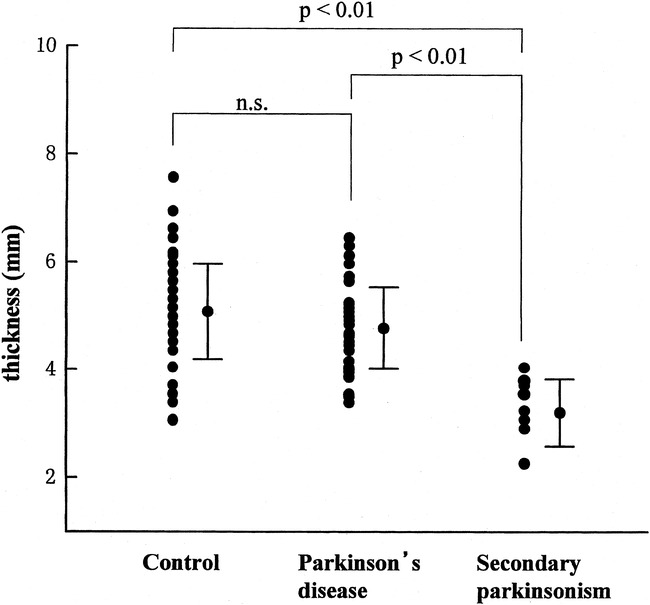 fig 3.