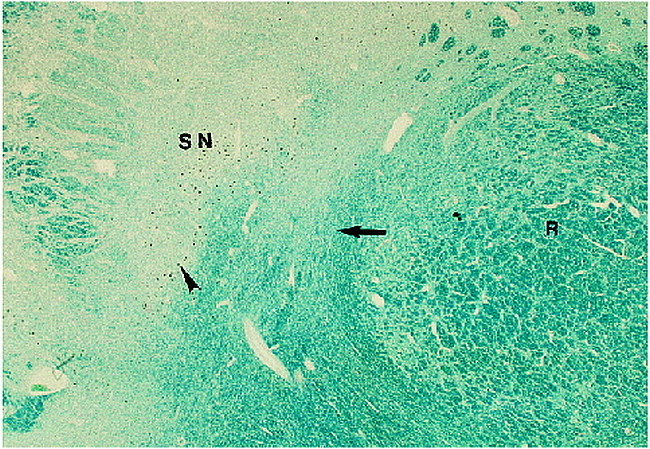 fig 1.