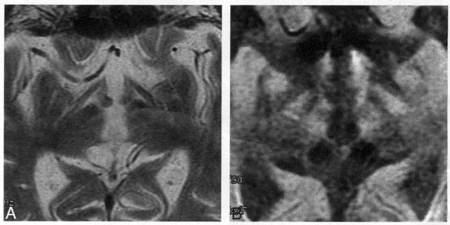 fig 7.