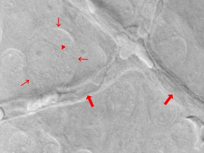 Fig. (2b)