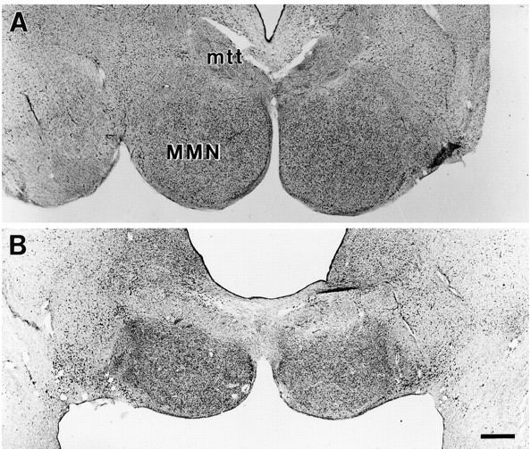 Fig. 15.