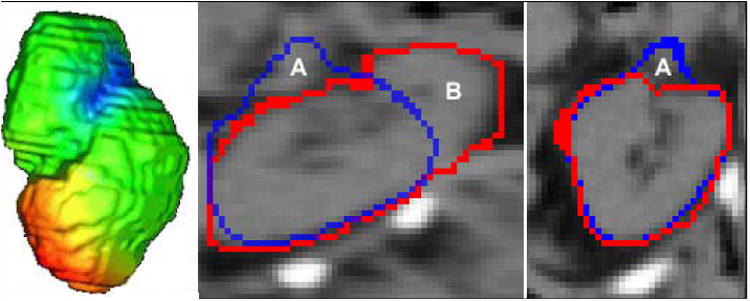 Fig. 16