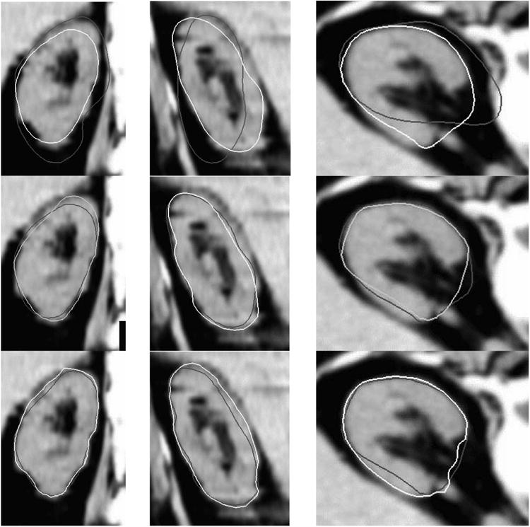 Fig. 11