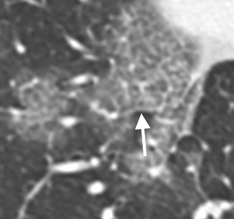 Figure 3: