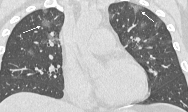 Figure 2: