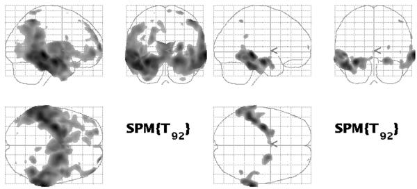 Fig 10