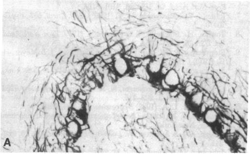 graphic file with name pnas00645-0331-e.jpg