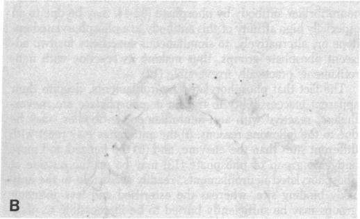 graphic file with name pnas00645-0331-f.jpg