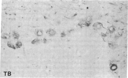 graphic file with name pnas00645-0331-b.jpg