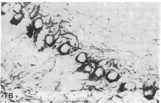 graphic file with name pnas00645-0329-b.jpg