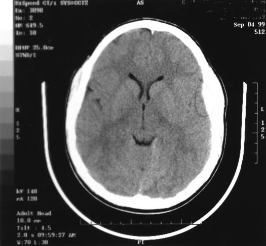 graphic file with name i1062-6050-036-04-0433-f01.jpg