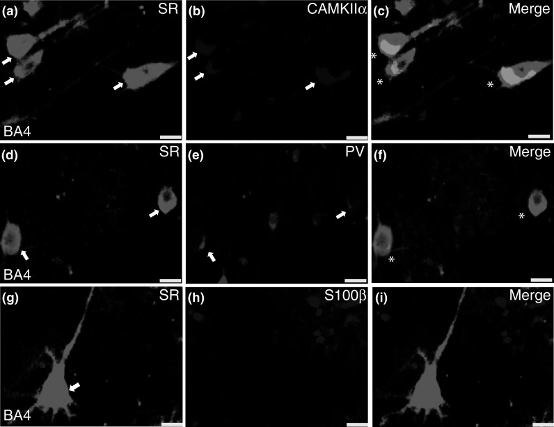 Fig. 12