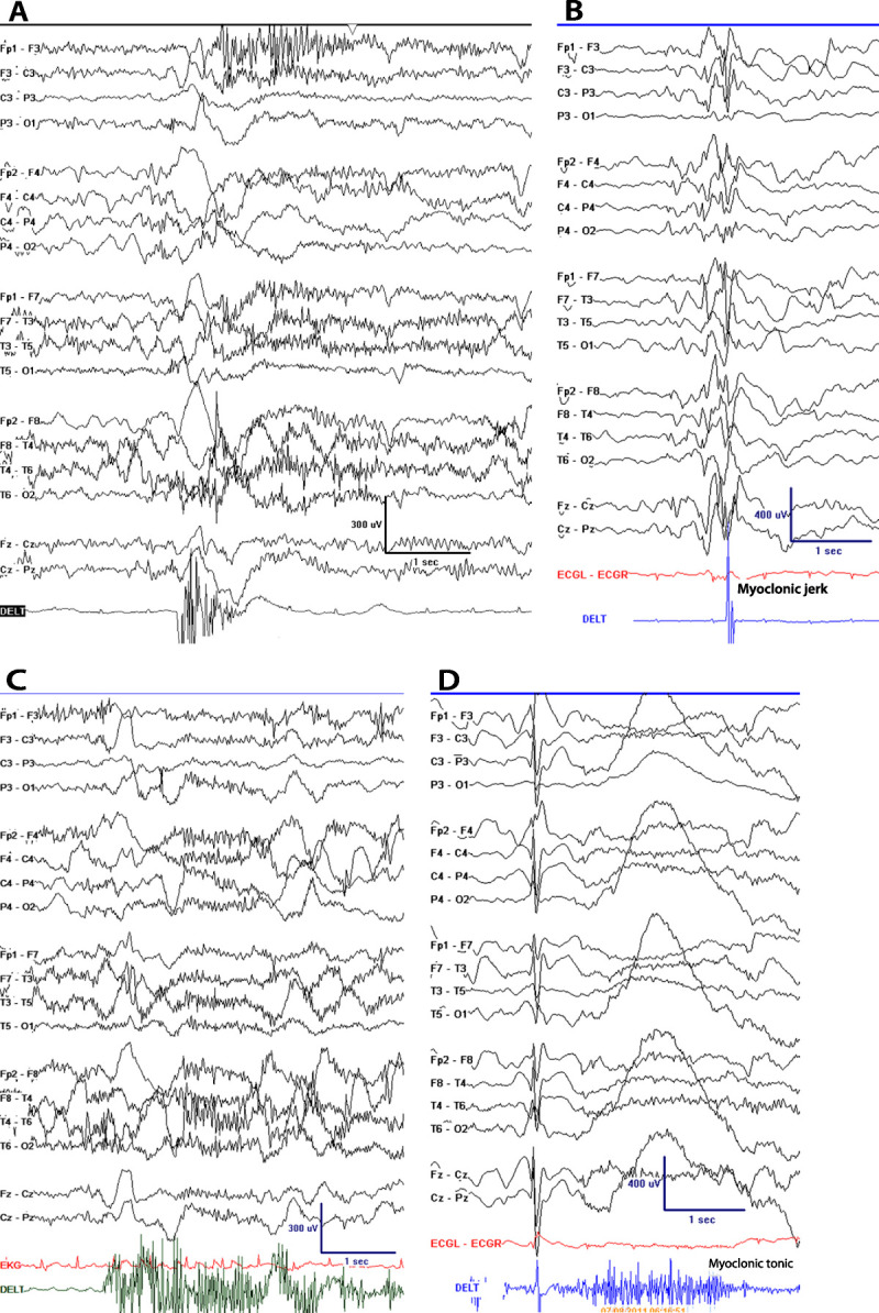 Figure 1-3.